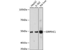 Western blot analysis of extracts of various cell lines, using SERPINC1 Rabbit mAb (ABIN7270208) at 1:1000 dilution. (SERPINC1 Antikörper)