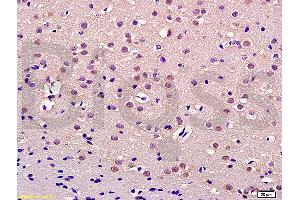Formalin-fixed and paraffin embedded rat brain labeled with Anti-Thrap3/TRAP150 Polyclonal Antibody, Unconjugated (ABIN1387545) at 1:200 followed by conjugation to the secondary antibody and DAB staining (THRAP3 Antikörper  (AA 631-730))