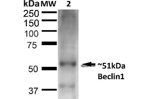 Western blot analysis of Rat Liver showing detection of ~51 kDa Beclin 1 protein using Rabbit Anti-Beclin 1 Polyclonal Antibody (ABIN2868751). (Beclin 1 Antikörper  (FITC))