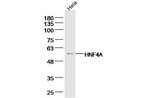 Hela lysates probed with TRAF2 Polyclonal Antibody, Unconjugated  at 1:300 dilution and 4˚C overnight incubation. (TRAF2 Antikörper  (AA 401-501))