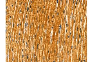 ABIN6261761 and ABIN6266840 at 1/100 staining Rat heart tissue by IHC-P. (FKRP Antikörper  (N-Term))