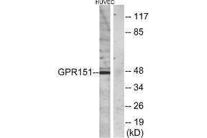 Western blot analysis of extracts from HUVEC cells, using GPR151 antibody. (GPR151 Antikörper  (C-Term))