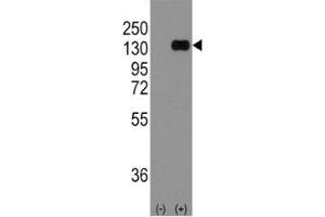 Western Blotting (WB) image for anti-Cadherin 1, Type 1, E-Cadherin (Epithelial) (CDH1) (AA 833-862) antibody (ABIN3030244)