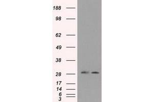 Image no. 1 for anti-Replication Protein A2, 32kDa (RPA2) antibody (ABIN1500734) (RPA2 Antikörper)