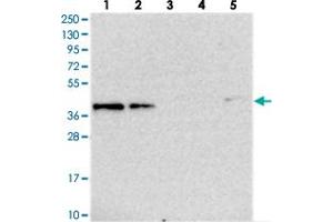 Western blot analysis of Lane 1: RT-4, Lane 2: U-251 MG, Lane 3: Human Plasma, Lane 4: Liver, Lane 5: Tonsil with TMEM164 polyclonal antibody  at 1:250-1:500 dilution. (TMEM164 Antikörper)