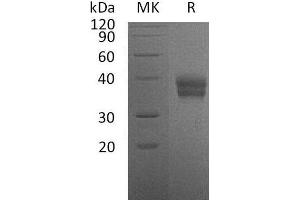 Western Blotting (WB) image for Carbonic Anhydrase 12 (CA12) protein (His tag) (ABIN7320477) (CA12 Protein (His tag))