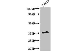 Western Blot Positive WB detected in: Mouse brain tissue All lanes: ZFP42 antibody at 3 μg/mL Secondary Goat polyclonal to rabbit IgG at 1/50000 dilution Predicted band size: 35 kDa Observed band size: 35 kDa (ZFP42 Antikörper  (AA 6-68))