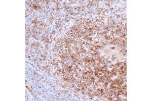 Immunohistochemistry (IHC) image for anti-HLA-DR-gamma (CD74) antibody (ABIN7449435) (CD74 Antikörper)