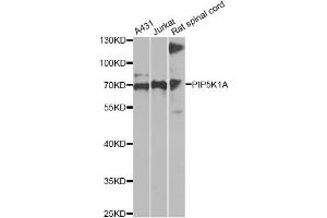 Western blot analysis of extracts of various cell lines, using PIP5K1A antibody (ABIN6292233) at 1:1000 dilution. (PIP5K1A Antikörper)