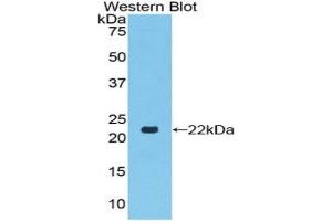 Western blot analysis of the recombinant protein. (TLR7 Antikörper  (AA 887-1036))
