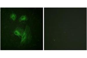 Immunofluorescence analysis of HeLa cells, using p70 S6 Kinase (Ab-229) Antibody.