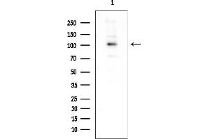 anti-Retinoblastoma 1 (RB1) (C-Term) antibody