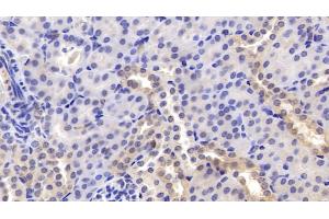 Immunohistochemistry (IHC) image for anti-serpin Peptidase Inhibitor, Clade F (Alpha-2 Antiplasmin, Pigment Epithelium Derived Factor), Member 1 (SERPINF1) (AA 19-417) antibody (ABIN7428680)
