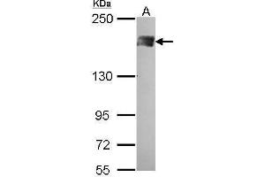 WB Image Sample (30 ug of whole cell lysate) A: A431 , 5% SDS PAGE PB1 antibody antibody diluted at 1:500 (Polybromo 1 Antikörper  (N-Term))