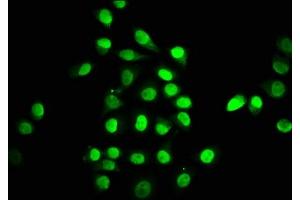 Immunofluorescence (IF) image for anti-TEA Domain Family Member 1 (SV40 Transcriptional Enhancer Factor) (TEAD1) (AA 135-215) antibody (ABIN7172758)