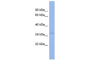 WB Suggested Anti-MSI2 Antibody Titration:  0. (MSI2 Antikörper  (Middle Region))