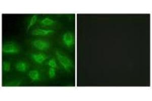 Immunofluorescence analysis of HeLa cells, using DGKI antibody. (DGKI Antikörper  (C-Term))