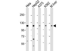 Western Blot at 1:2000 dilution Lane 1: Hela whole cell lysate Lane 2: HepG2 whole cell lysate Lane 3: A375 whole cell lysate Lane 4: K562 whole cell lysate Lane 5: mouse liver lysate Lysates/proteins at 20 ug per lane. (IDE Antikörper  (AA 406-435))