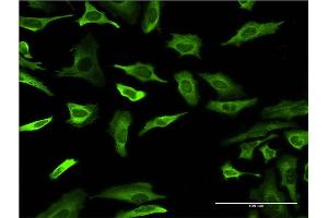 Immunofluorescence of monoclonal antibody to FABP4 on HeLa cell.