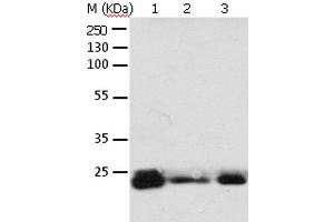 Western Blot analysis of 293T cell and Mouse brain tissue, A549, Hela, A172 and HT-29 cell using RAB6A Polyclonal Antibody at dilution of 1:650 (RAB6A Antikörper)