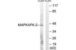 Western blot analysis of extracts from HuvEc cells, treated with Adriamycin 0. (MAPKAP Kinase 2 Antikörper  (AA 188-237))