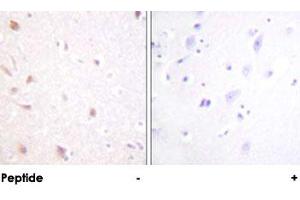 Immunohistochemical analysis of paraffin-embedded human brain tissue using MKI67IP polyclonal antibody . (NIFK Antikörper)