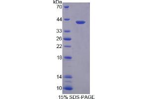 Image no. 1 for Myosin Binding Protein C, Slow Type (MYBPC1) (AA 1-277) protein (His tag) (ABIN4989822) (MYBPC1 Protein (AA 1-277) (His tag))