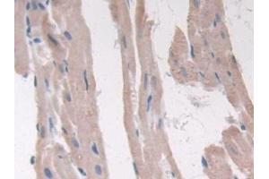 Immunohistochemistry (IHC) image for anti-Adiponectin Receptor 2 (ADIPOR2) (AA 1-147) antibody (ABIN7431158)