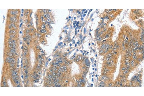 Centromere Protein C Pseudogene 1 (CENPCP1) Antikörper