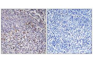 Immunohistochemistry (IHC) image for anti-Holocytochrome C Synthase (HCCS) (Internal Region) antibody (ABIN1850244) (HCCS Antikörper  (Internal Region))