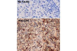 IHC of human appendix using anti-CD4 antibody and FFPE tissue after heat-induced antigen retrieval. (CD4 Antikörper)