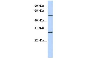 Western Blotting (WB) image for anti-Ring Finger Protein 217 (RNF217) antibody (ABIN2458748) (RNF217 Antikörper)