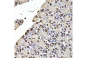Immunohistochemistry of paraffin-embedded rat pancreas using LMNB2 antibody at dilution of 1:200 (400x lens). (Lamin B2 Antikörper)