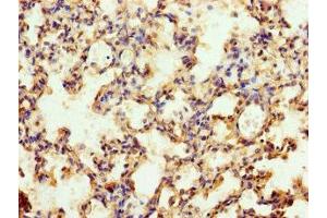 Immunohistochemistry of paraffin-embedded human lung tissue using ABIN7174683 at dilution of 1:100 (MFSD11 Antikörper  (AA 191-238))