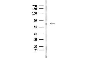 Western blot analysis of lysates from PC12 cells, using Osteopontin Antibody at 1/1000 dilution.