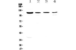 Western blot analysis of RPGR using anti-RPGR antibody . (RPGR Antikörper  (AA 13-338))
