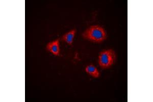 Immunofluorescent analysis of Aurora A (pT288) staining in HEK293T cells.