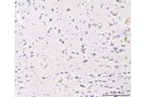 IHC analysis of PLD3 using anti-PLD3 antibody (ABIN7599439). (PLD3 Antikörper  (AA 1-490))