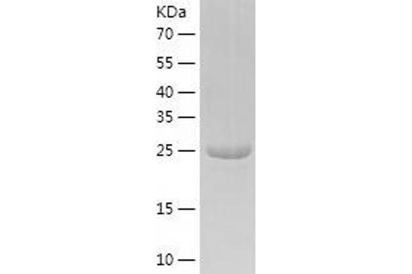 NMNAT3 Protein (AA 1-252) (His tag)