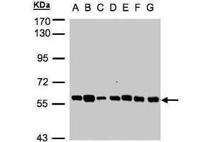 WB Image Sample(30 ug whole cell lysate) A: 293T B: A431 , C: H1299 D: HeLa S3 , E: Hep G2 , F: MOLT4 , G: Raji , 7. (TULP1 Antikörper)