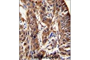Immunohistochemistry (Paraffin-embedded Sections) (IHC (p)) image for anti-Aldehyde Dehydrogenase 3 Family, Member A1 (ALDH3A1) (AA 69-99), (N-Term) antibody (ABIN392318)