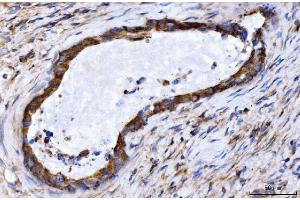 IHC analysis of GIGYF2 using anti-GIGYF2 antibody (ABIN7601679).