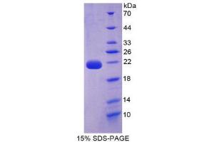 SDS-PAGE (SDS) image for Interleukin 22 (IL22) (AA 34-179) protein (His tag) (ABIN2125481)