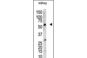 Antibody is used in Western blot to detect UBCE7IP3 in mouse kidney tissue lysate. (RBCK1 Antikörper  (N-Term))
