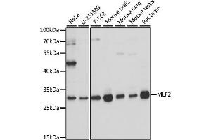 Western blot analysis of extracts of various cell lines, using MLF2 antibody (ABIN7268725) at 1:1000 dilution. (MLF2 Antikörper  (AA 1-65))