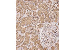 Immunohistochemistry (Paraffin-embedded Sections) (IHC (p)) image for anti-serpin Peptidase Inhibitor, Clade A (Alpha-1 Antiproteinase, Antitrypsin), Member 6 (SERPINA6) (AA 197-225) antibody (ABIN654693)