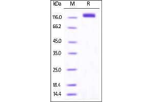 SDS-PAGE (SDS) image for VEGF Receptor 2 (VEGFR2) (AA 20-764) (Active) protein (His tag,AVI tag,Biotin) (ABIN3137661)