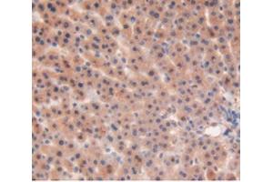 Immunohistochemistry (IHC) image for anti-Matrix Metallopeptidase 12 (Macrophage Elastase) (MMP12) (AA 20-99) antibody (ABIN7431755)