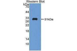 Western blot analysis of the recombinant protein. (Follistatin Antikörper  (AA 35-283))