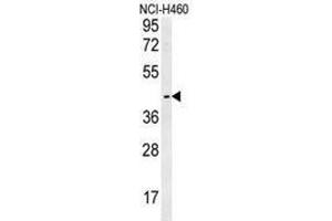 Western blot analysis in NCI-H460 cell line lysates (35ug/lane) using LAPTM5  Antibody (N-term). (LAPTM5 Antikörper  (N-Term))